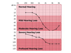 hearing_loss